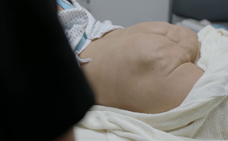 Megan Barkley Butt, Prosthetic Scene in The Pitt